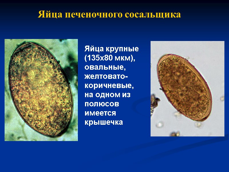 Яйца печеночного сосальщика Яйца крупные (135х80 мкм), овальные, желтовато-коричневые,  на одном из полюсов